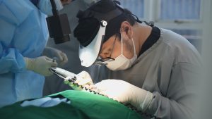 Atasi Kebotakan dengan Transplantasi Rambut: Prosedur Hingga Biaya