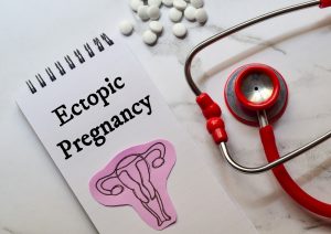 catatan kecil dengan teks Ectopic Pregnancy