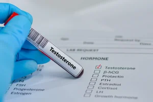7 Ciri Testosteron Rendah & Cara Tepat Mengatasinya