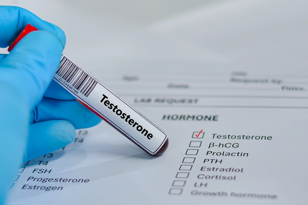 7 Ciri Testosteron Rendah & Cara Tepat Mengatasinya