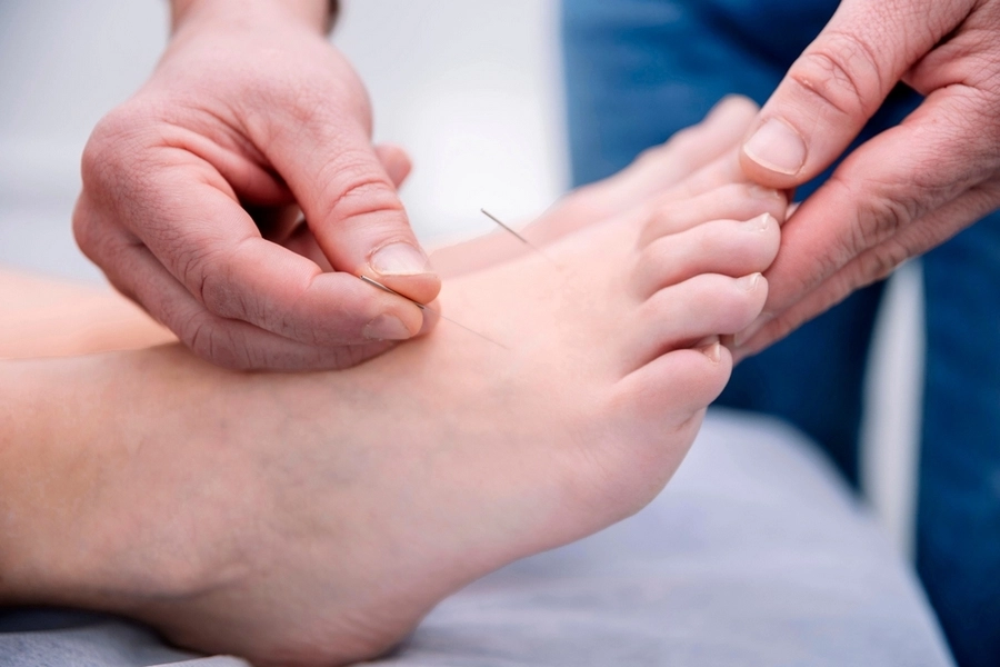 Titik Akupunktur di Kaki dan Manfaatnya