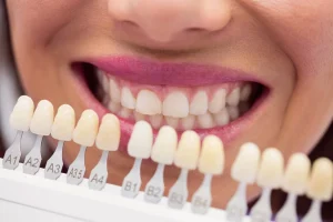 Ramai Veneer Gigi Bikin Bau Mulut, Cek Faktanya!